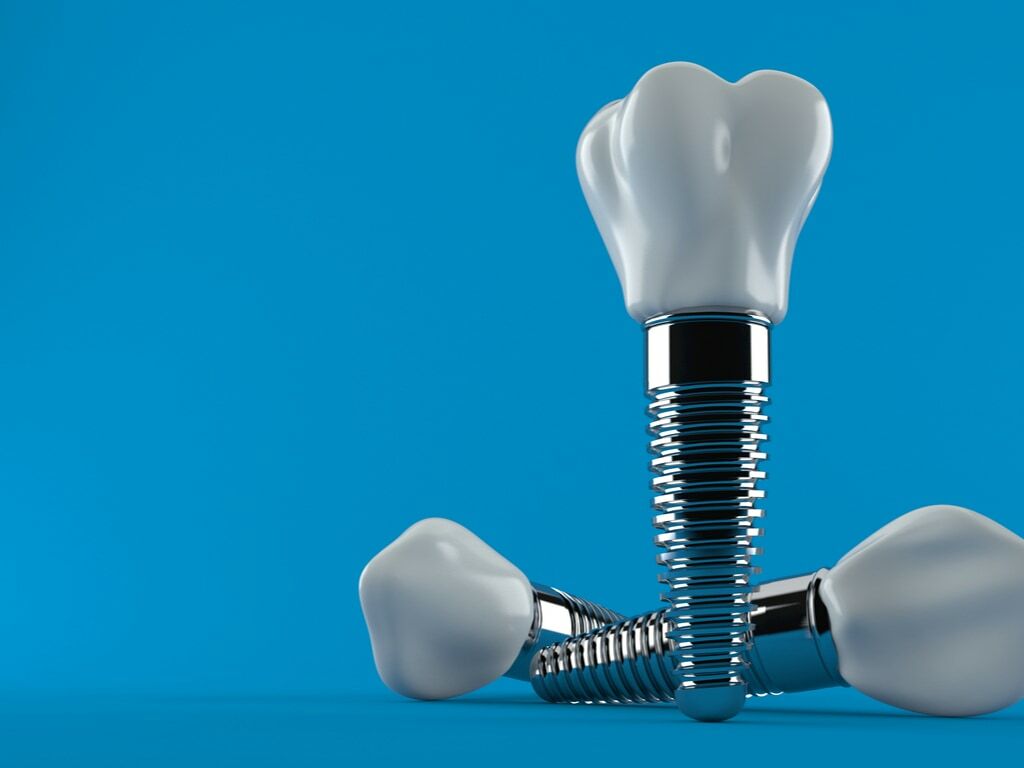 implants_dentaires_sur_fond_bleu